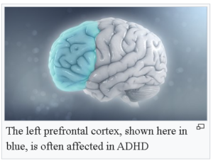 Children with Attention Deficit Disorder (ADHD)